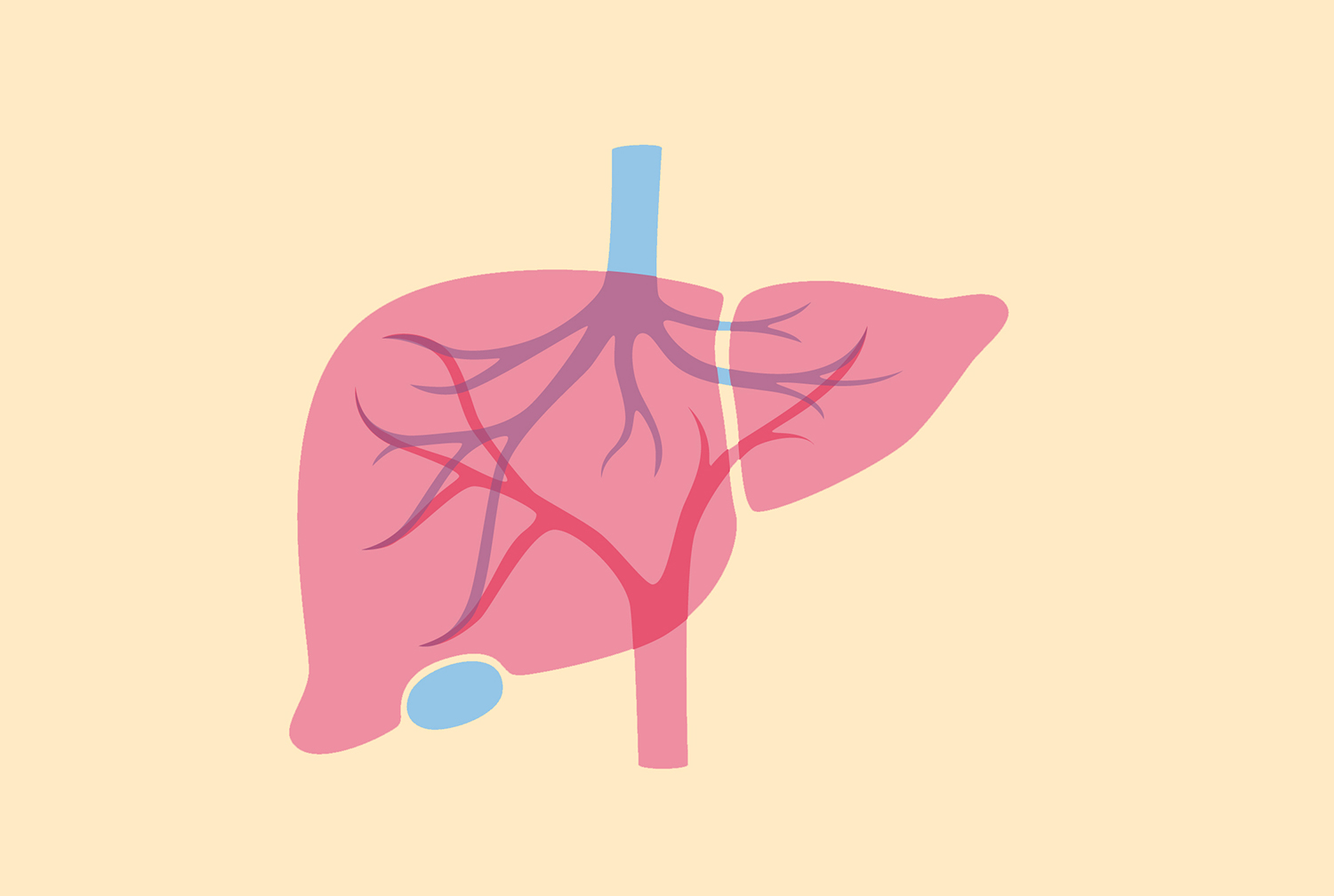 Liver transplantation.HS.21 HS_M6_2018