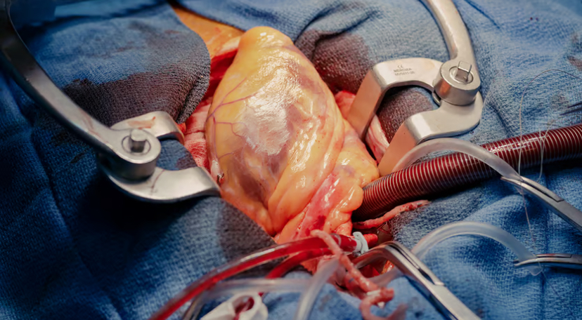 Актуальні питання кардіохірургії 3